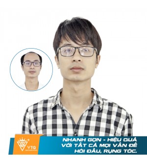 Tóc Giả Nam Trùm Nguyên Đầu - VTG C01